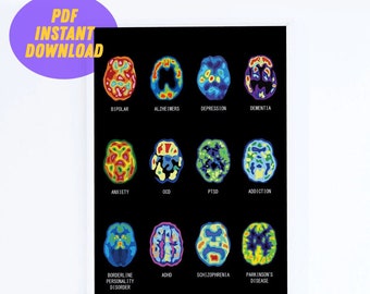 Brain Scan Digital Art Print & BONUS Embroidery Pattern | MRI PET Cat Scan Mental Health Psychology Neurology Anxiety Ocd Bipolar Depression