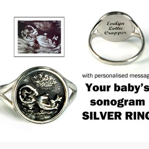 Birth announcement, mom ring, Gift for new mum, Pregnancy announcement, New mum gift, Personalised baby ultrasound Jewelry,Miscarriage ring