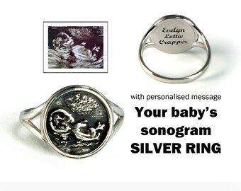Bague échographie personnalisée pour bébé, argent sterling, cadeau de grossesse