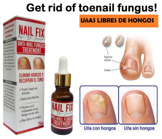 Fingernail Fungus from Acrylic Nails: Causes, Treatment, More