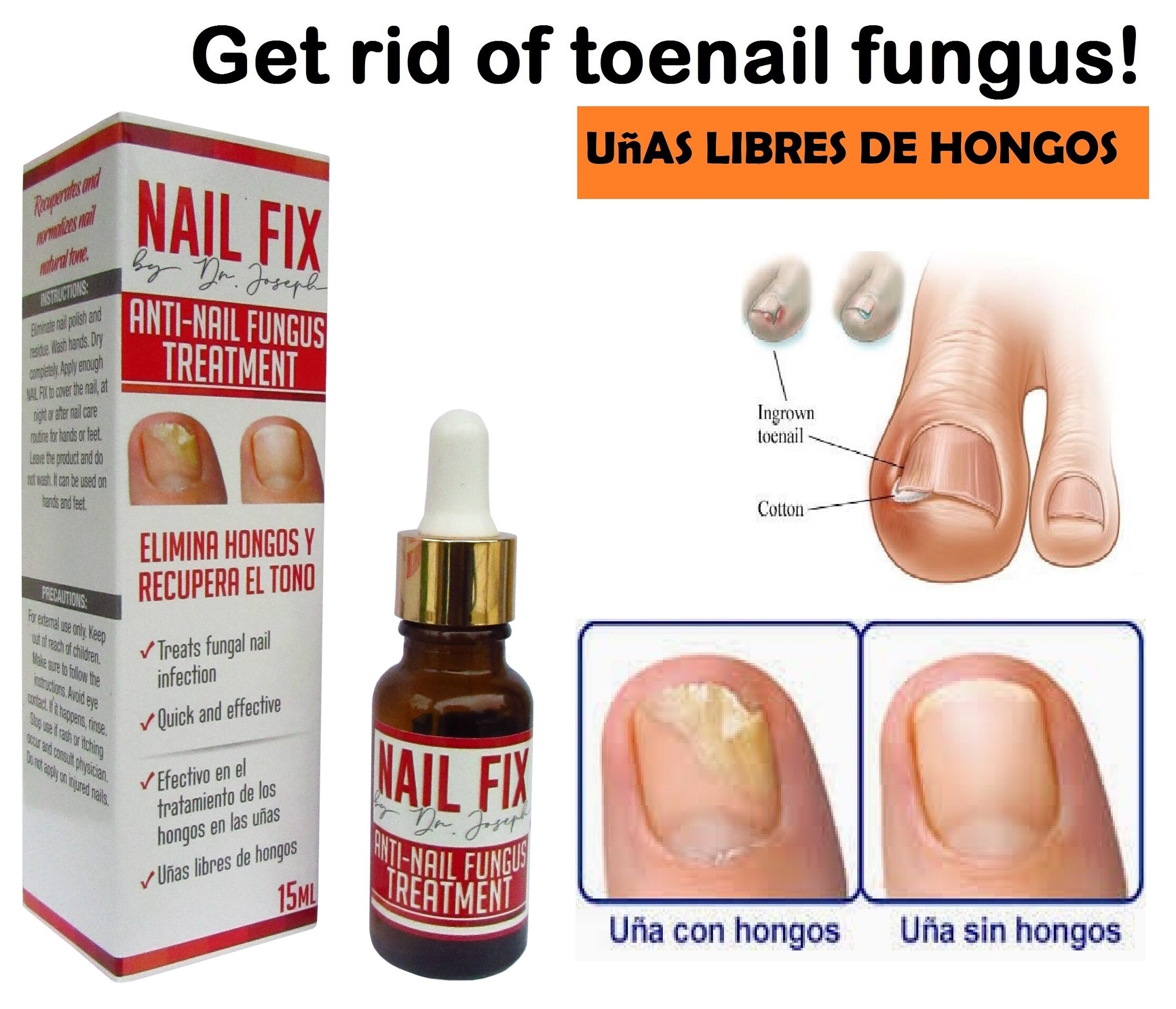 Anti Fungal 7 Roots Natural Toe & Nail Fungus Oil – 2 Fl Oz – With Tea Tree & Aloe – USA Made