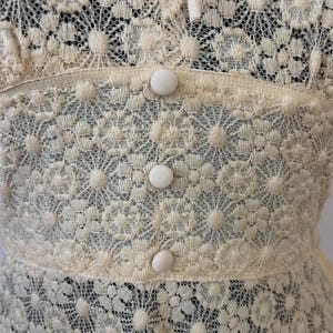 May include: Close-up of a cream-colored lace fabric with a floral pattern. The fabric has a series of white buttons down the center.