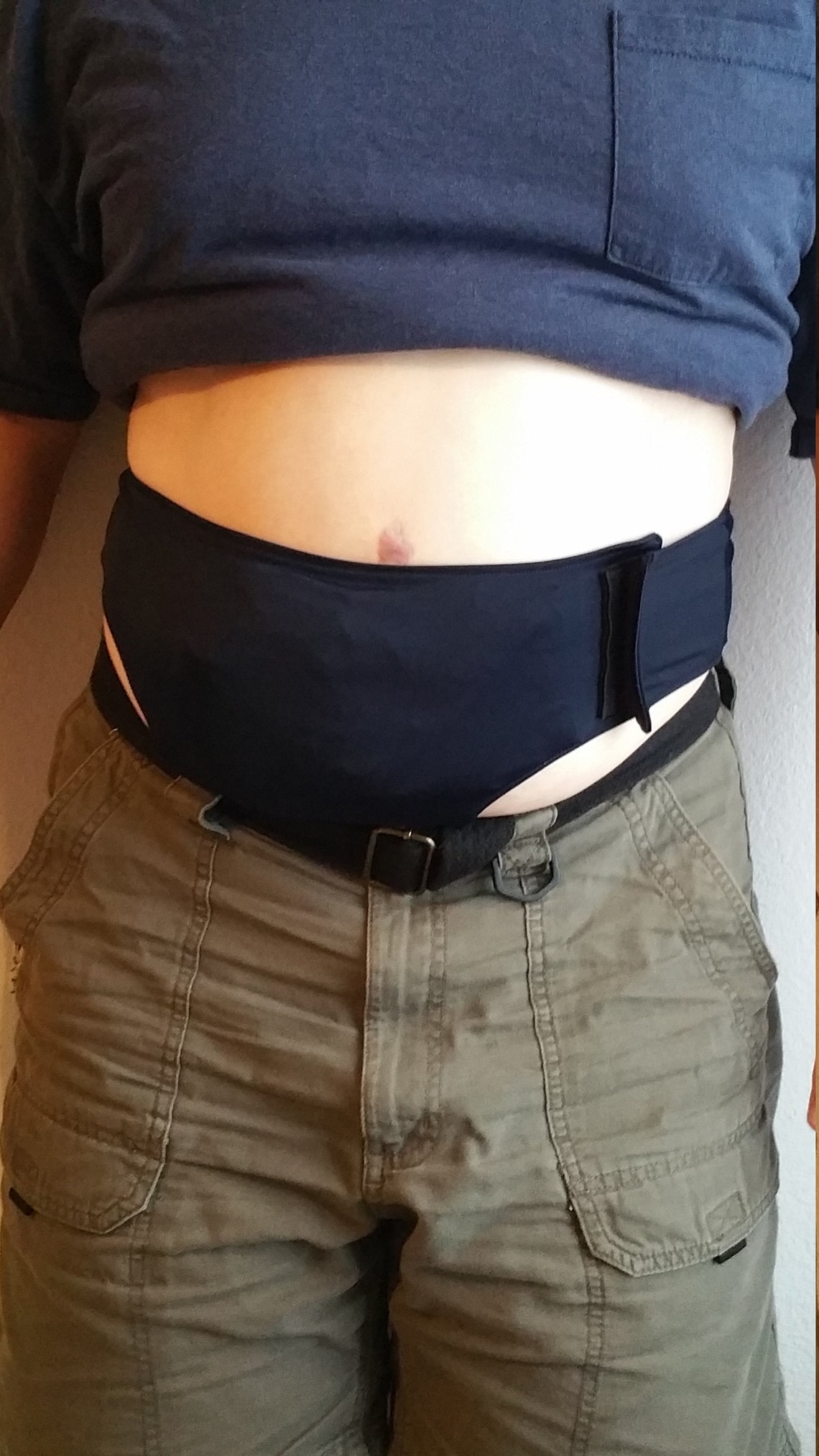 Adult TBelt for Urostomies Ostomy Belt Ostomy Pouch Cover Etsy