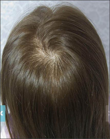 reborn hair rooting
