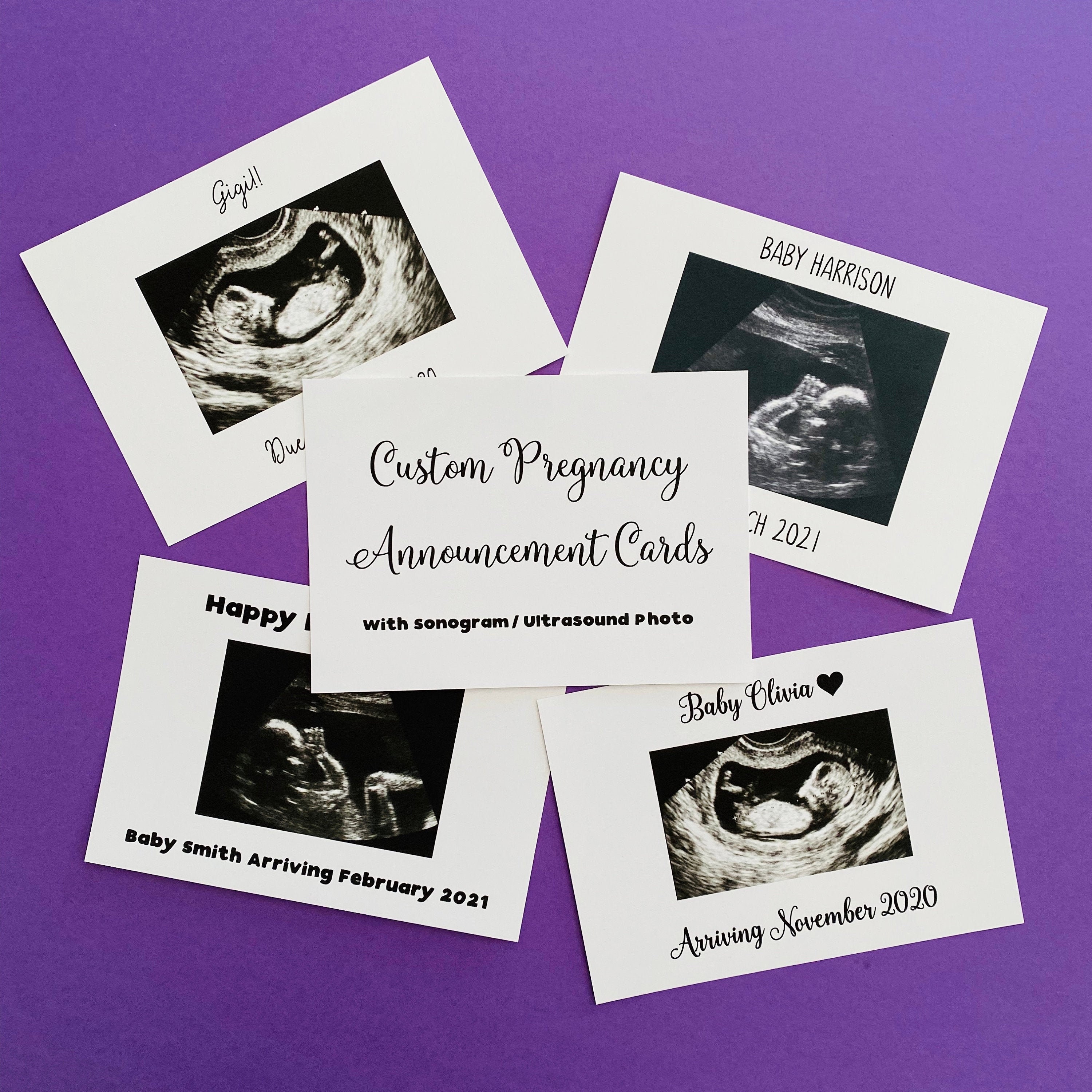 Custom Pregnancy Announcement Card Ultrasound Card Etsy
