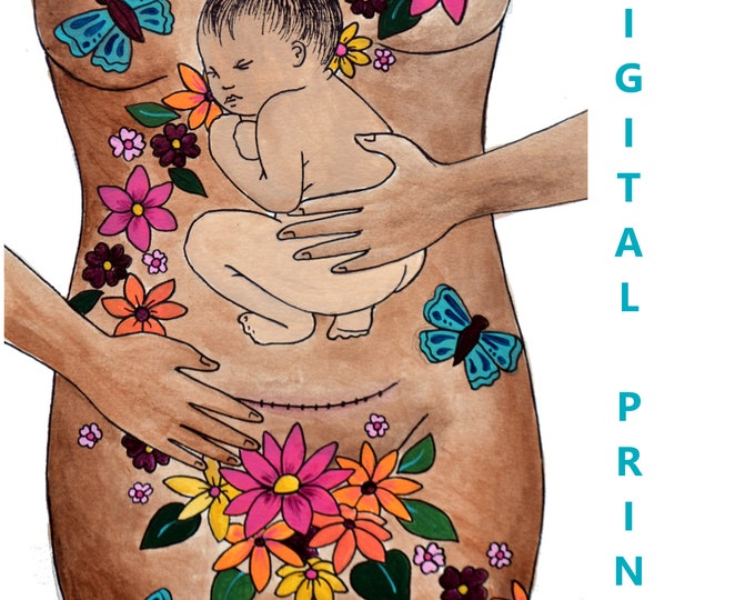 DIGITAL "Transform" print/poster /Birth Art/ csection/ cesarean birth/ doula/ gift for new mom