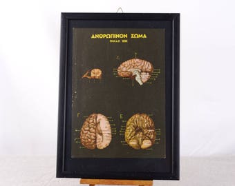 Brain Anatomy, Human Brain Poster, Anatomy Print, Medical Decor, Brain Poster, Human Brain Wall Art, Human Brain Decor, Medical Curiosity