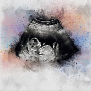 Baby Ultrasound Art,, Watercolor Sonogram Print, Baby Shower Gift, Gender Reveal, Sonography Art, Pregnancy Gift, Ultrasound Art for Wall