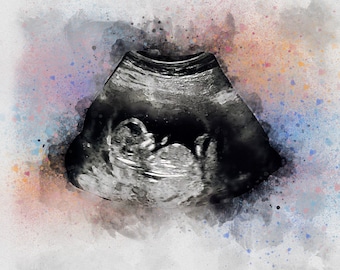 Baby Ultrasound Art, Watercolor Sonogram Print, Baby Shower Gift, Gender Reveal, Sonography Art, Pregnancy Gift, Ultrasound Art for Wall