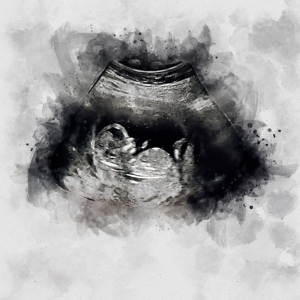 Baby Ultrasound Art,, Watercolor Sonogram Print, Baby Shower Gift, Gender Reveal, Sonography Art, Pregnancy Gift, Ultrasound Art for Wall