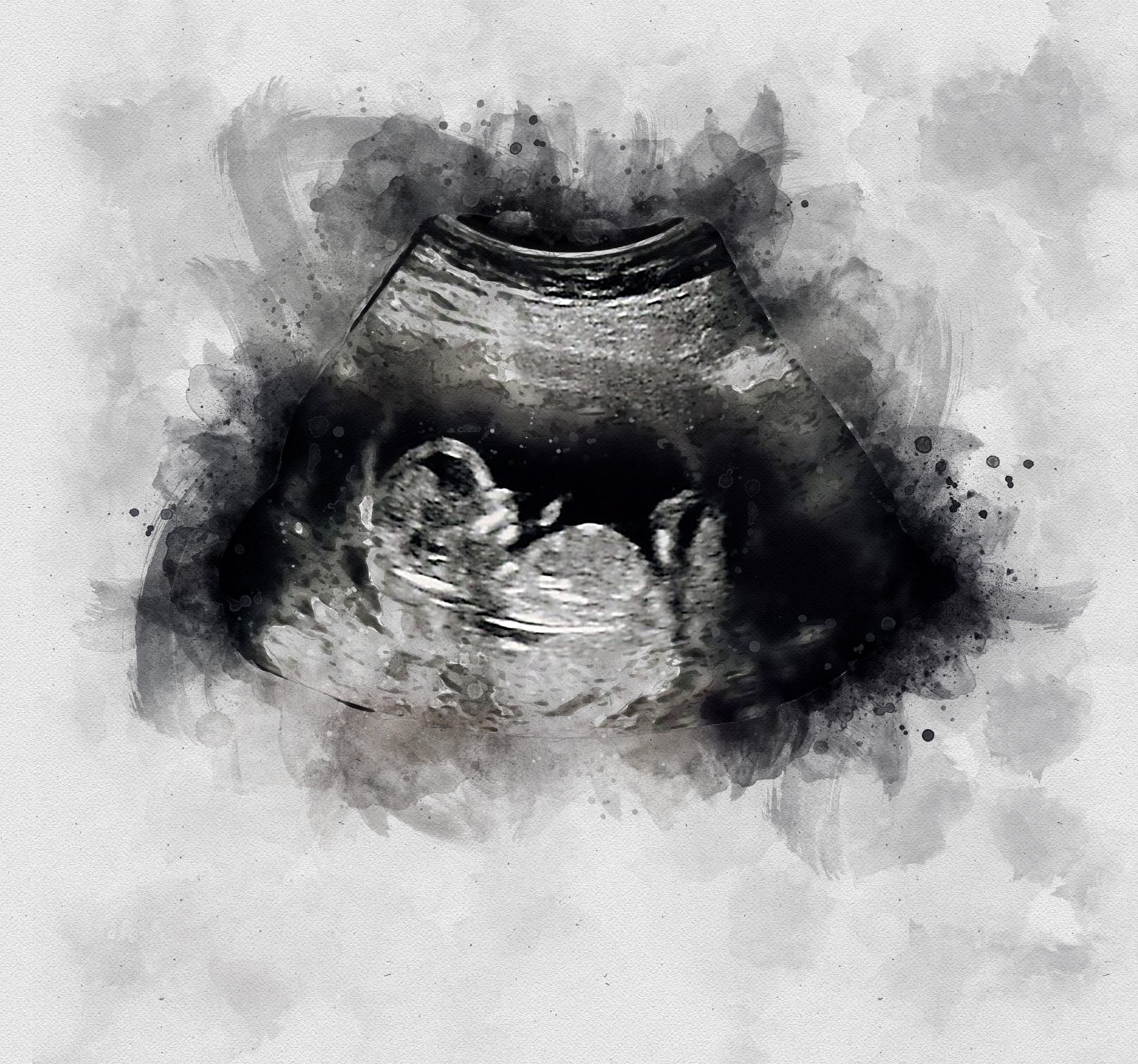Cadre d'échographie de sonogramme de grossesse Le sexe révèle le