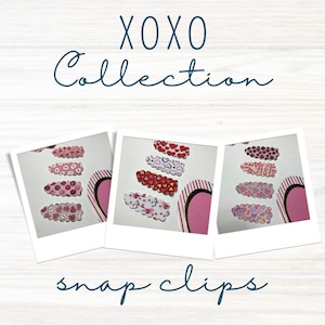 Valentine’s Day Snap Clip | Faux Leather Scallop Snap Clip | Valentine’s Day Scallop Snap Clip | Scallop Snap Clip | Faux Leather Snap Clip