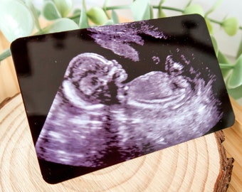 Baby Scan Gift - Baby Scan Wallet Card Insert - Sonogram Gift - New Daddy Gift - Pregnancy Scan Keepsake