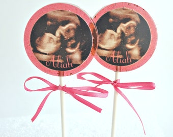 Ultrasound baby shower lollipop favors, baby shower favors, ultrasound suckers baby shower treats, photo customized candy, SET OF 6