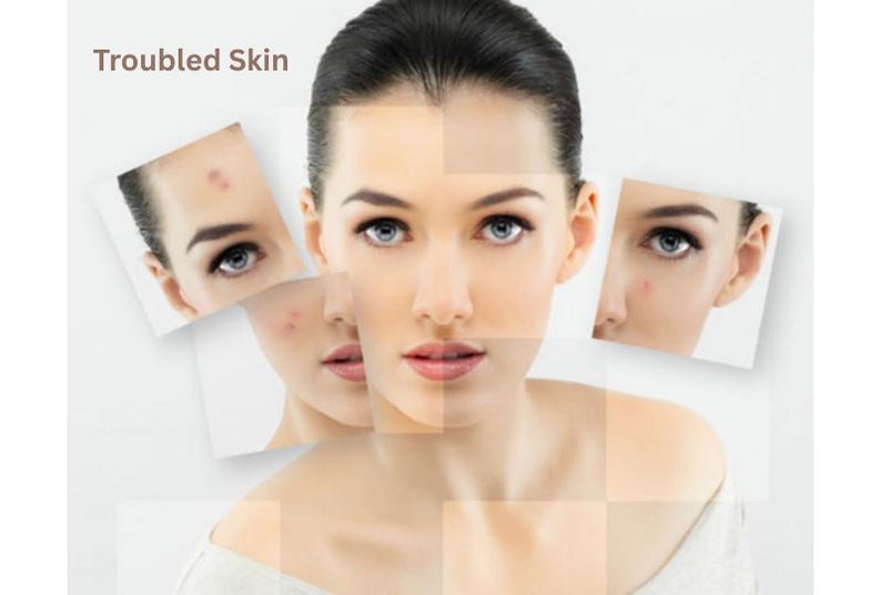 Pure Hyaluronic Acid Serum | Plant Based | Double Strength Hydrating Serum image 11