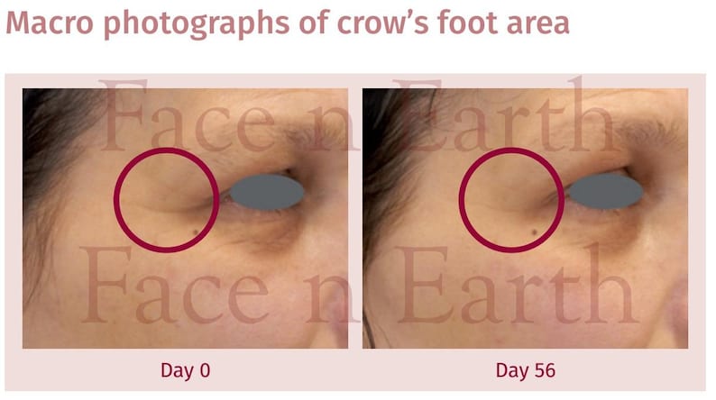 Puede incluir: Fotograf&iacute;as macro, lado a lado, del &aacute;rea de las patas de gallo alrededor del ojo. La imagen muestra el &aacute;rea antes y despu&eacute;s del tratamiento. El texto en la parte superior dice "Macro photographs of crow's foot area". El texto en la parte inferior dice "Day 0" y "Day 56".