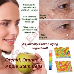 May include: A skincare advertisement featuring a person, a green apple, and before-and-after skin comparisons. Text includes: Preserves the youthful look & vitality of your skin, Skin Recovers Elasticity from 12 Years ago, Skin Recovers Luminosity it had 14 years ago, A Clinically Proven aging Ingredient! Orchid, Orange & Apple Stem Cells.