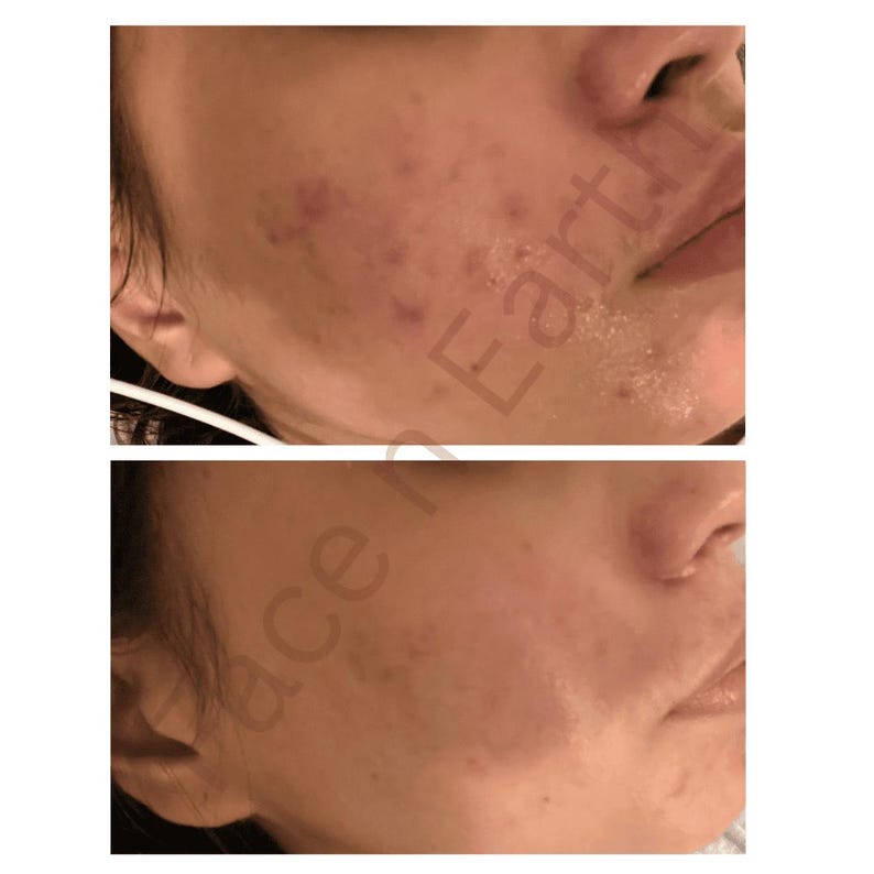 Colloidal Silver Face Cleanser - Green Tea, Chamomile - Vegan-Friendly image 11