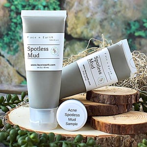 Spotless Mud Clay - THAT WORKS on Blemishes