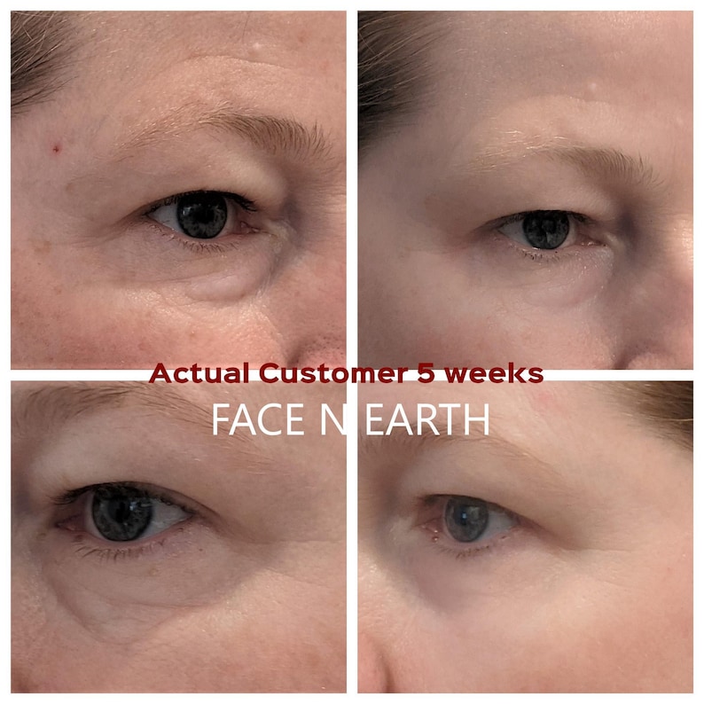 Puede incluir: Imagen de cuatro paneles que muestra vistas de primer plano del &aacute;rea de los ojos de una persona. El texto "Actual Customer 5 weeks" y "FACE N EARTH" se superpone a la imagen. La imagen muestra el antes y el despu&eacute;s de un producto para el cuidado de la piel.
