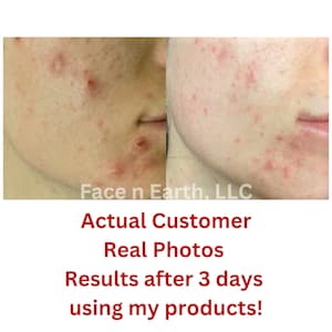 Deep Pore Face Wash | Purifying White Willow Bark Cleanser for Oil-Prone Skin image 6