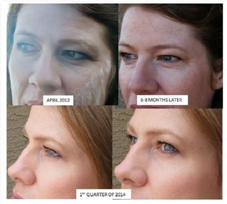 DMAE MSM Caffeine Dark Circles Wrinkles Bags under Etsy