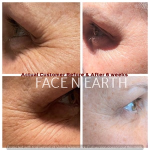 May include: Before and after photos showing the results of a skincare product. The image shows a close-up of a person's eye area. The top left photo shows wrinkles around the eye. The top right photo shows smoother skin around the eye. The bottom left photo shows wrinkles around the eye. The bottom right photo shows smoother skin around the eye. The text "Actual Customer Before & After 6 weeks FACE NEARTH" is visible in the image.