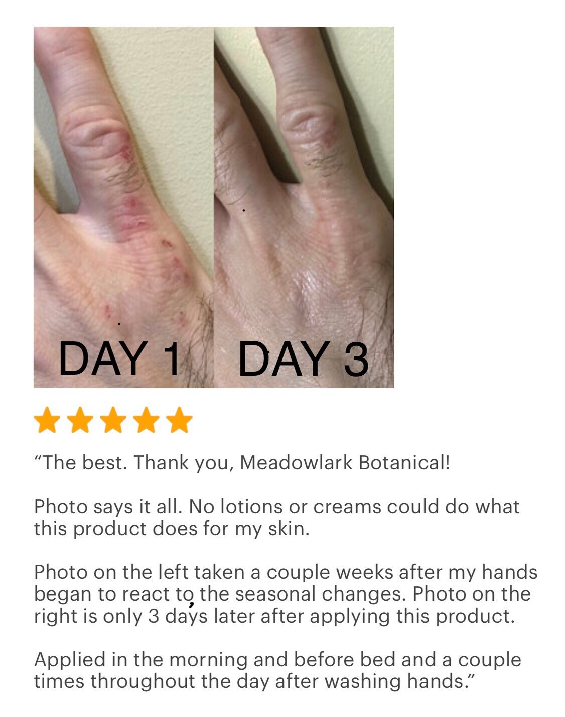 baby cream for adults