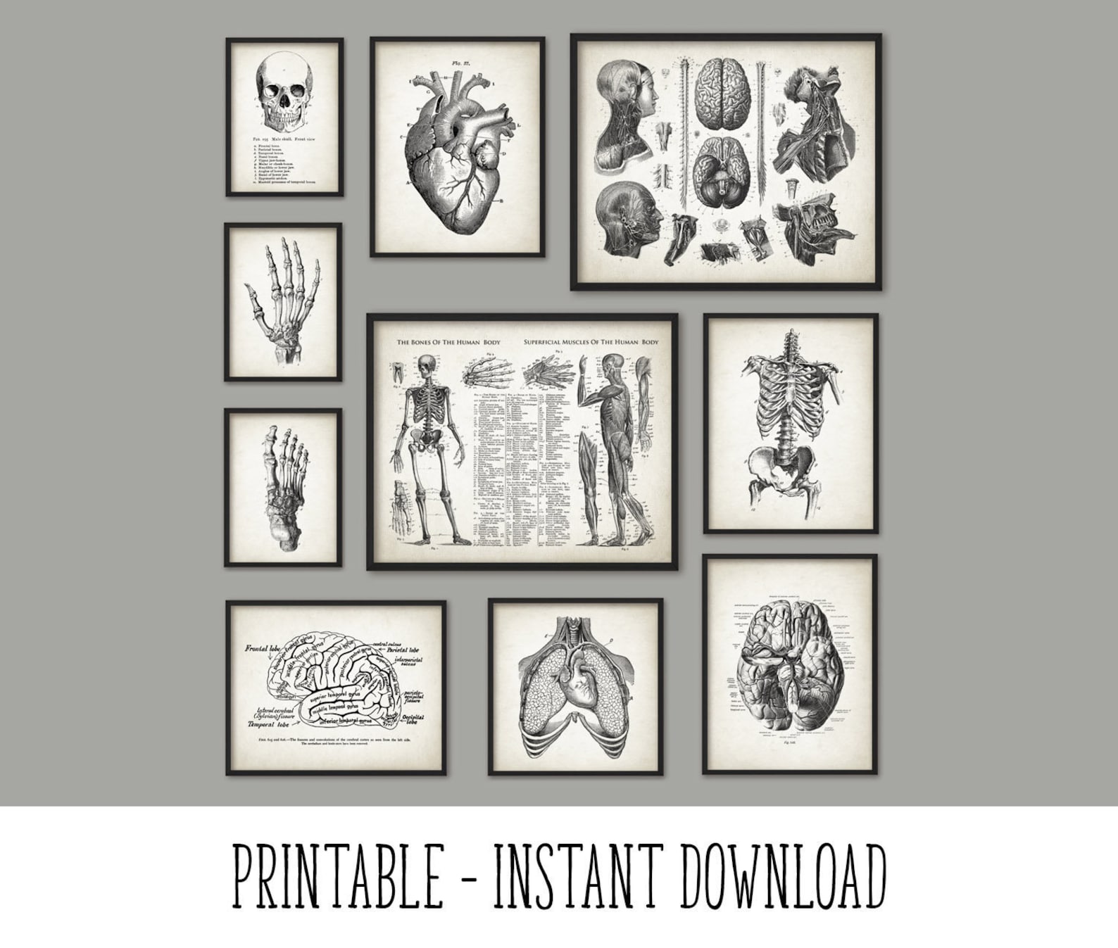 PRINTABLE Set of 10 Anatomy Images Vintage Wall Art Medical - Etsy