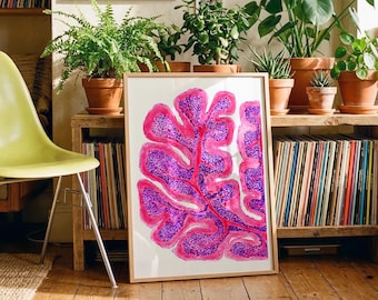 Aquarell Kleinhirn Kunstdruck: Medizinische Pathologie Poster (Digitaler Download)