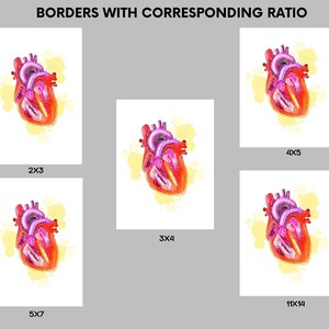 May include: Anatomical art print featuring a detailed illustration of a human heart in shades of red, pink, and purple, set against a yellow watercolor splash. The print is available in various sizes, including 2x3, 3x4, 4x5, 5x7, and 11x14.