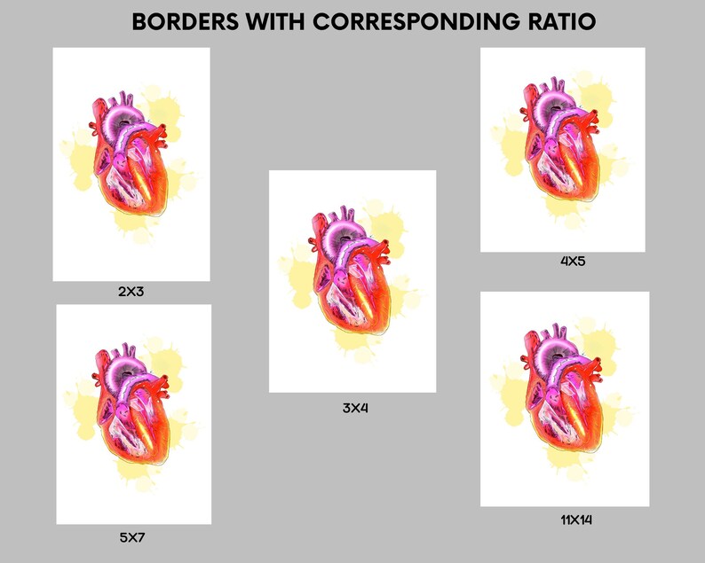 May include: Anatomical art print featuring a detailed illustration of a human heart in shades of red, pink, and purple, set against a yellow watercolor splash. The print is available in various sizes, including 2x3, 3x4, 4x5, 5x7, and 11x14.