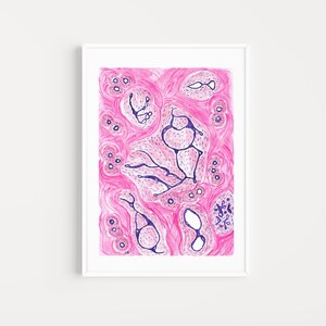Fibroadenoma histology art, breast histology art, anatomy printable art, histology printable art, doctor office wall decor, science poster