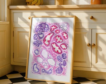 Fibrozystische Brust Histologie Aquarell Kunst: Pathologie Geschenk, Arzt Dekor (Digitaler Download)
