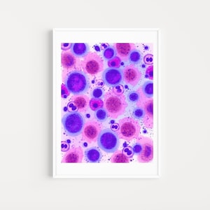Lymphoma histology art, histology printable art, hematopathology art, hematology art, oncologist gift, doctor office wall decor