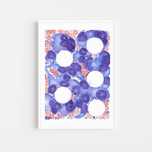 Multiple Myeloma Histology Watercolor Art Print: Hematology Pathology Decor (Digital Download