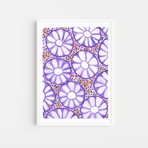 Colon Histology Art Print, Pathology Wall Decor, Anatomy Poster, Doctor Office Artwork, Medical Student Gift, Digital Download Printable
