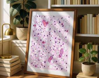Liposarkom Histologie Digital Druck: Pathologie Art, Arzt Büro Dekor (Digitaler Download)