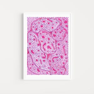 Ovarian tumor histology art print, Rare Pathology Wall Decor, Medical Student Gift, Doctor Office Artwork, Science printable, Anatomy Poster