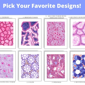 May include: A collection of eight framed watercolor illustrations of various medical conditions, including thyroid, colon, and multiple myeloma. Each artwork features a unique pattern of colors and shapes, with titles below each image. The text "Pick Your Favorite Designs!" is at the top.