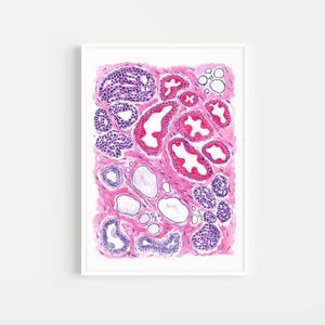 Fibrocystic changes of the breast histology art, breast pathologist gift, breast histology art, doctor office wall decor, biology poster