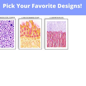 May include: The image displays three framed microscopic images. The text "Pick Your Favorite Designs!" is at the top. The first image is labeled "41. SPERMATOCYTIC TUMOR" and shows purple cells. The second is "42. MUCICARMINE STAIN" with yellow and red tissue. The third is "43. GROWTH PLATE" with red and white tissue.