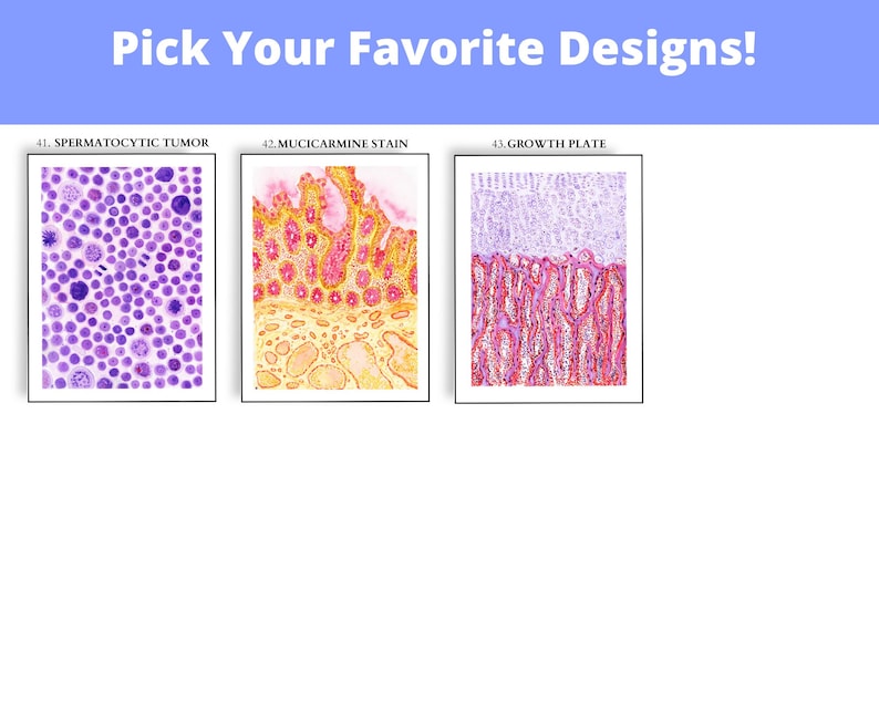 May include: The image displays three framed microscopic images. The text "Pick Your Favorite Designs!" is at the top. The first image is labeled "41. SPERMATOCYTIC TUMOR" and shows purple cells. The second is "42. MUCICARMINE STAIN" with yellow and red tissue. The third is "43. GROWTH PLATE" with red and white tissue.