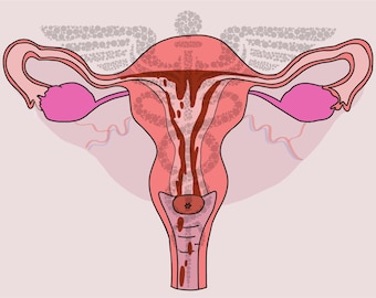 Anatomía del útero menstruante