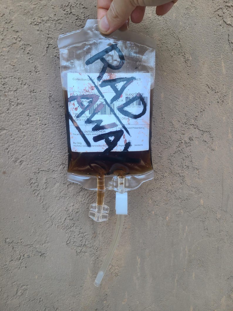 May include: A transparent plastic blood bag containing a dark brown liquid. The bag is marked with the word "RAD" in black marker. A label with printed text is visible, along with a clear attached tube.