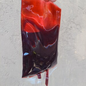 May include: A clear plastic bag filled with a dark red liquid, possibly blood. The liquid is layered, with a brighter red at the top and a darker shade at the bottom. Two tubes extend from the bottom of the bag. The bag is held by a person.
