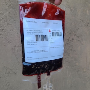 May include: A clear plastic bag filled with a dark red liquid, labelled "SL-5 RED BLOOD CELLS." The bag includes a barcode, blood type options, and text indicating it is from a volunteer donor. The bag is held by a hand.