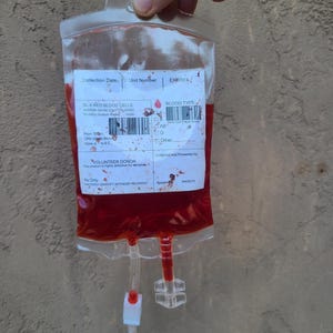 May include: A clear plastic blood bag filled with red liquid, held by a hand. The bag has attached tubes and printed labels with text including "SL-5 RED BLOOD CELLS" and "BLOOD TYPE".