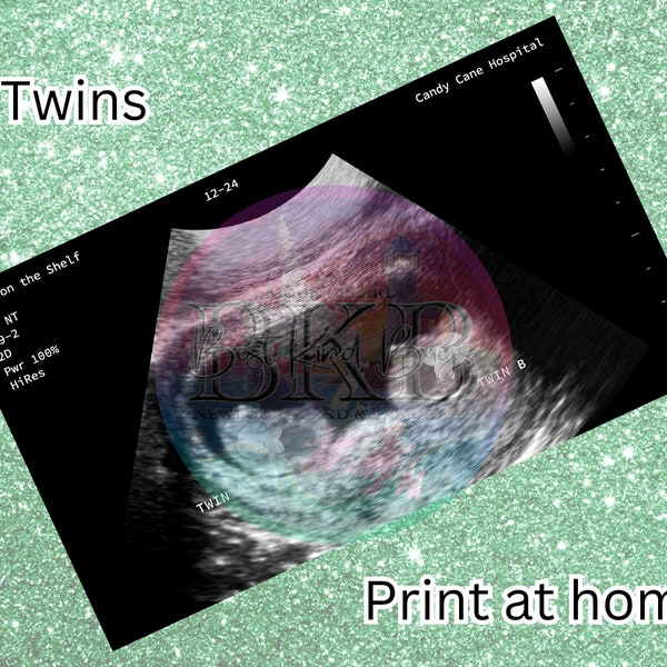Elf Baby Ultrasound - TWINS - PNG Digital Download - Printable - HIGH Resolution - High Quality