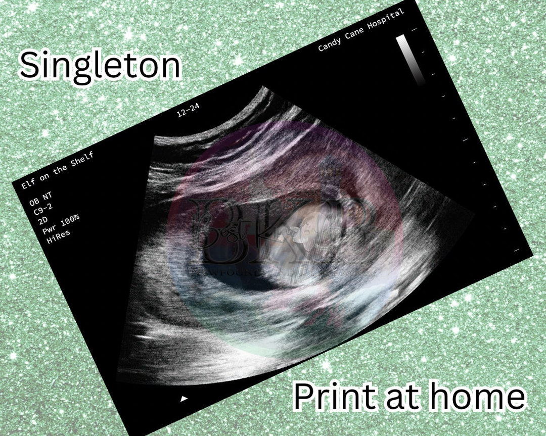 Elf Baby Ultrasound Singleton PNG Digital Download - Etsy